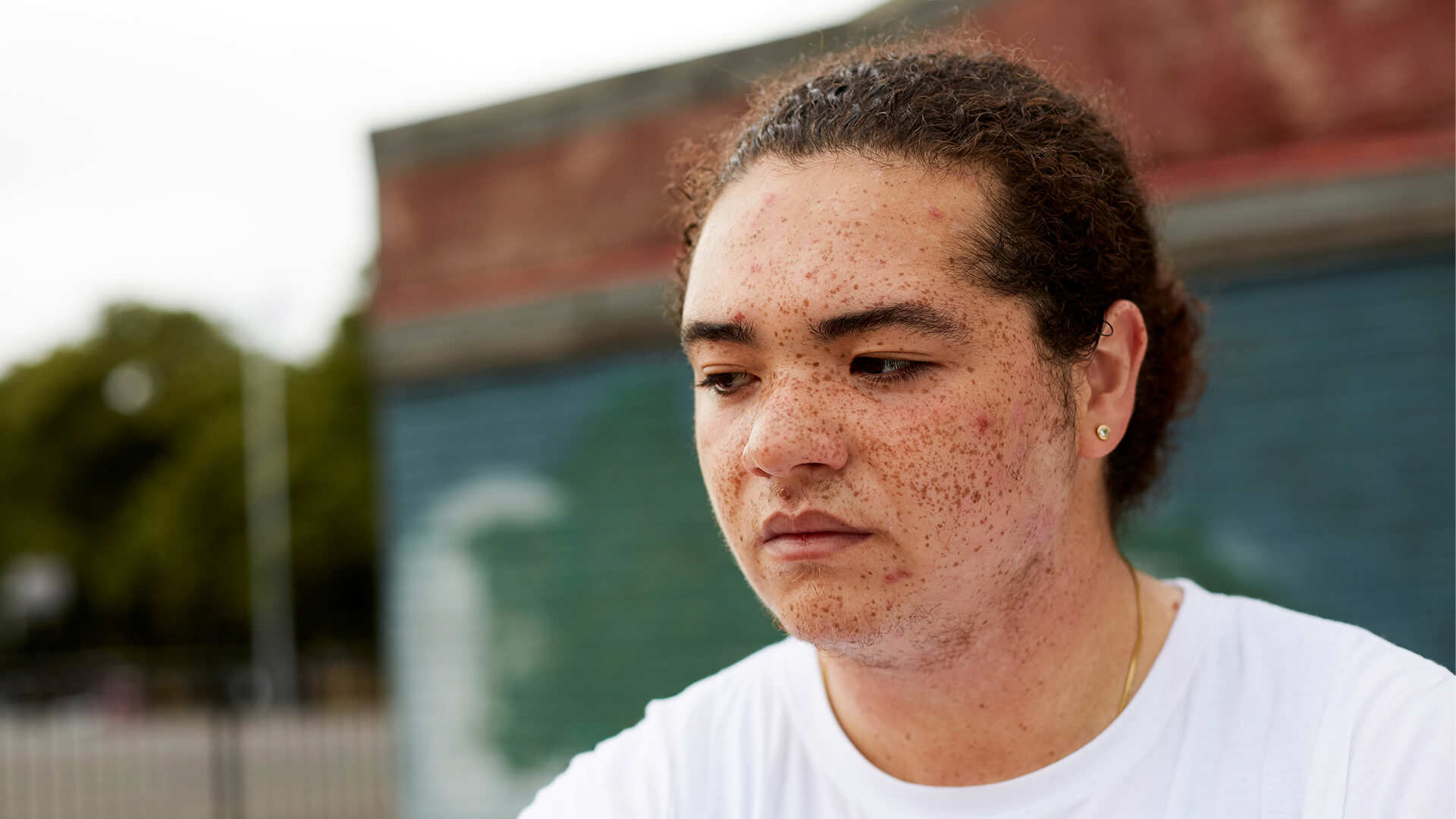 Close up of a boy sitting in a park. His expression seems worried as if deep in thought.